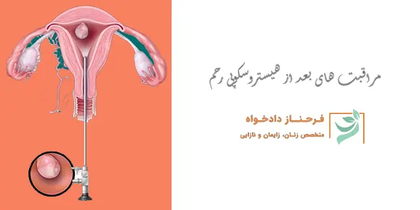 مراقبت های بعد از هیستروسکوپی رحم