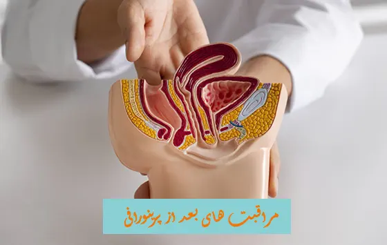 مراقبت بعد از پرینورافی